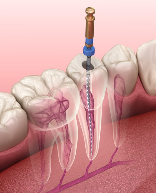 dental care service in dehradun