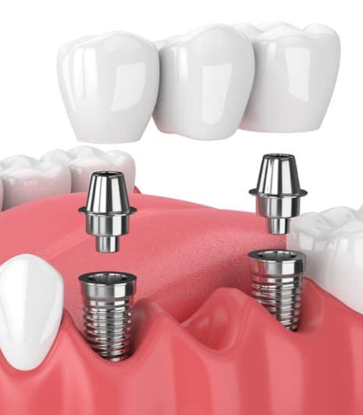 dental-img03 dental care